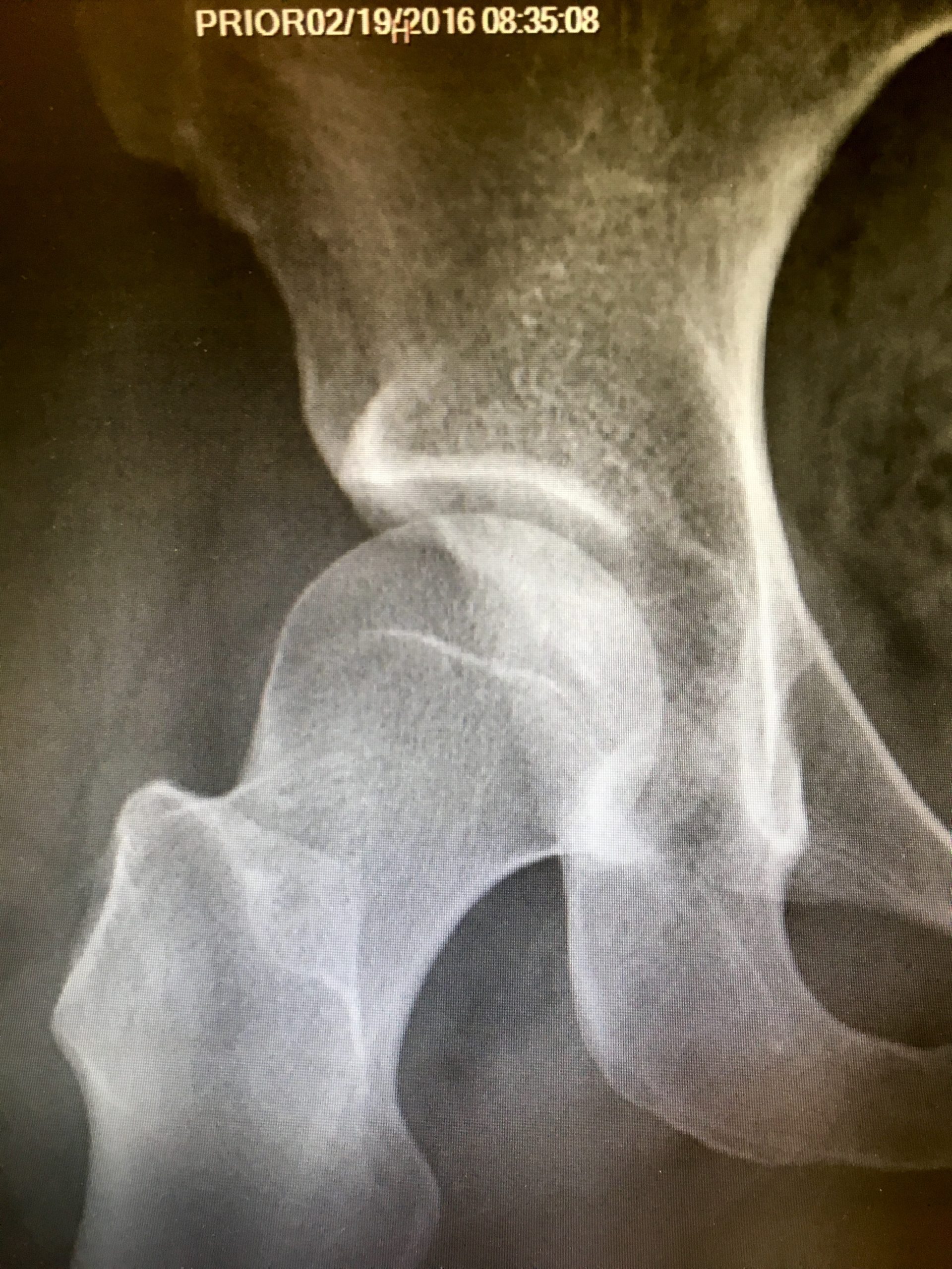 nicole-x-ray